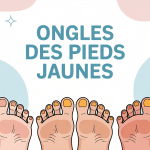 Illustration ongles des pieds jaunes santé