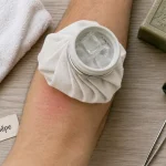 Que faire en cas de piqure de guepe : compresse froide et antiseptique
